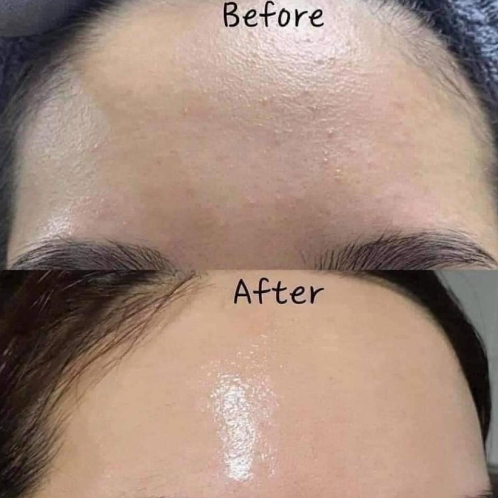 ANUA Heartleaf 70% Intense Calming Cream