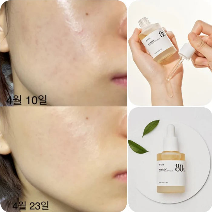 Anua Heartleaf 80% Moisture Soothing Ampoule