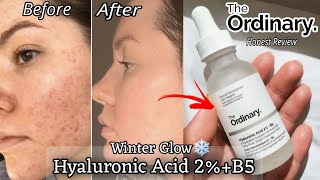 The Ordinary Hyaluronic Acid 2% + B5 Serum 60 ML